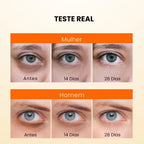 Creme Anti Olheiras e Rugas 20% De Vitamina C - Pele Clara e Rejuvenescida JoyPretty