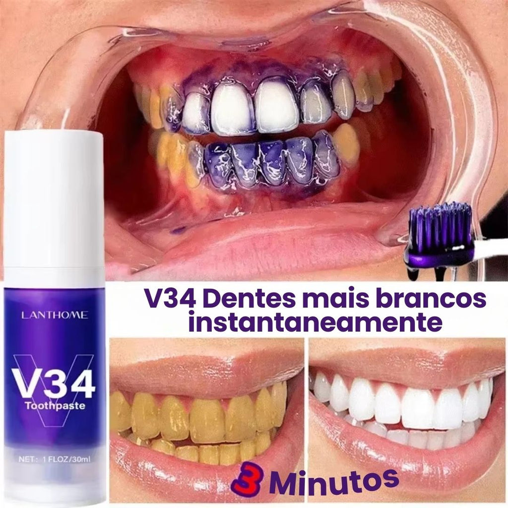 Clareador Dental Cream V34