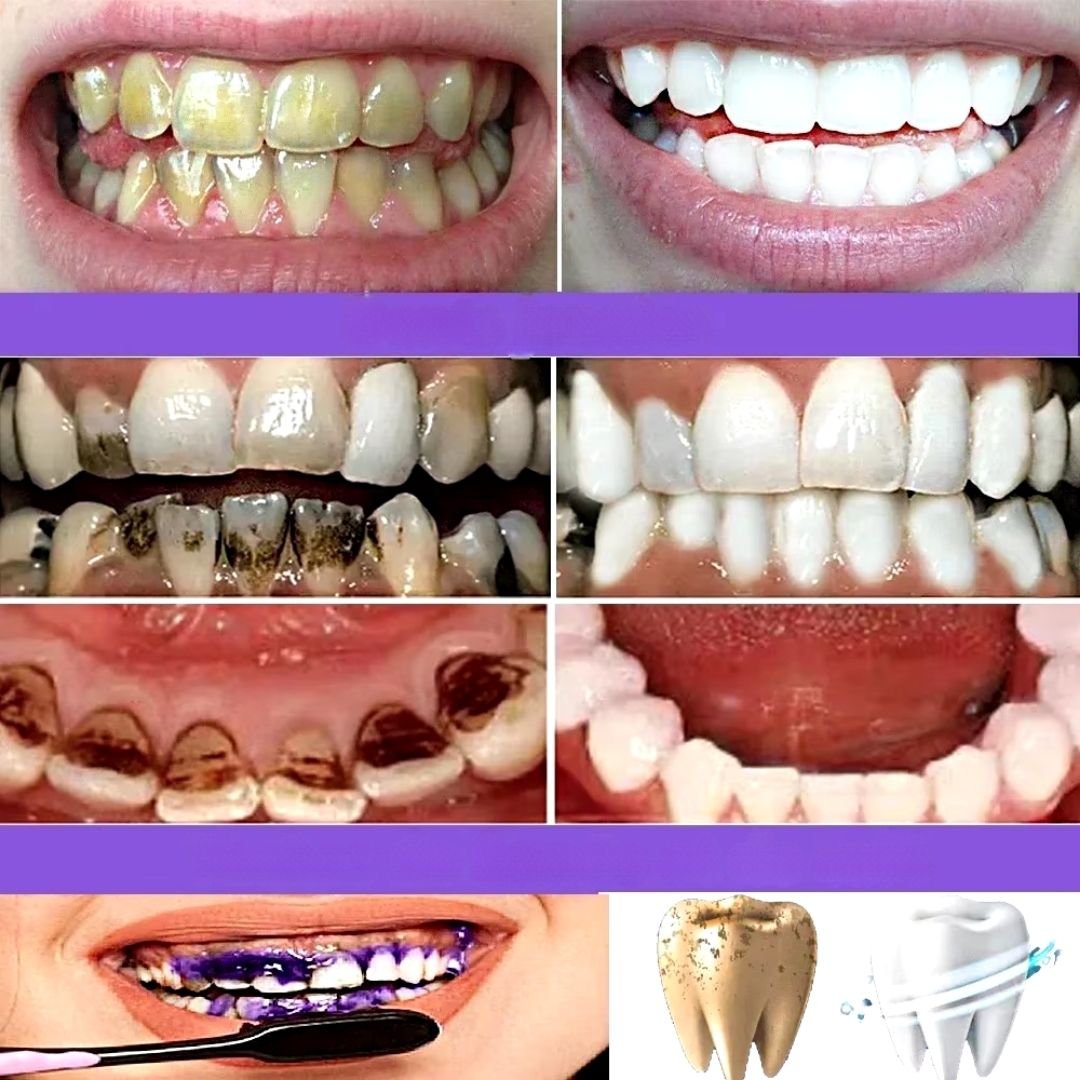 Clareador Dental Cream V34