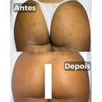 Clareador De Manchas Natural - Amazole™