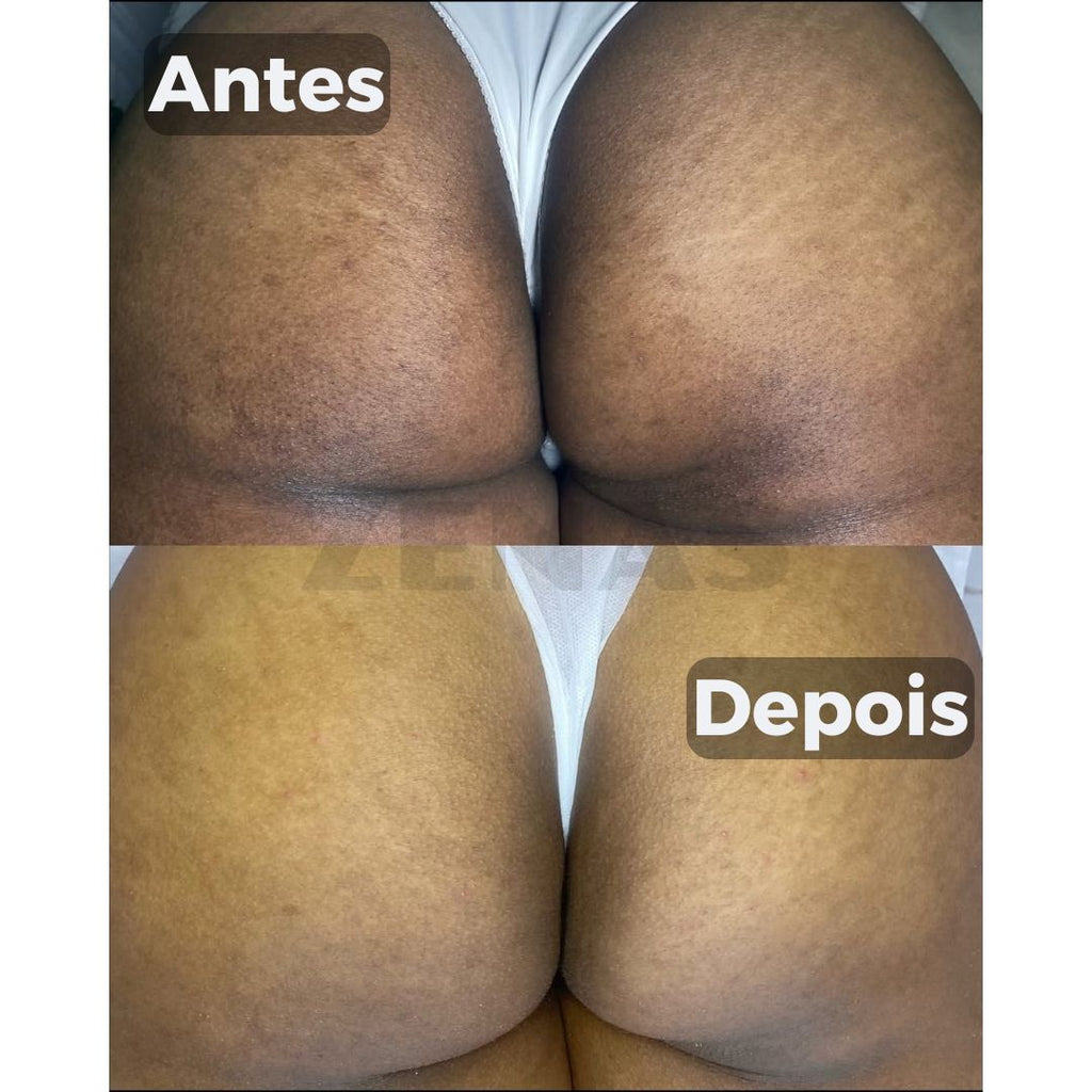 Clareador De Manchas Natural - Amazole™