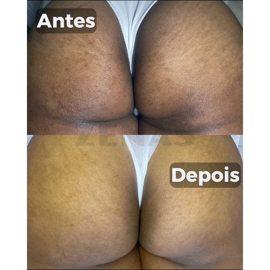 Clareador De Manchas Natural - Amazole™