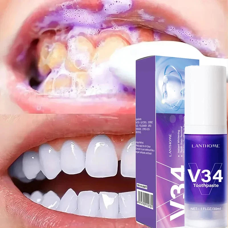 Clareador Dental Cream V34