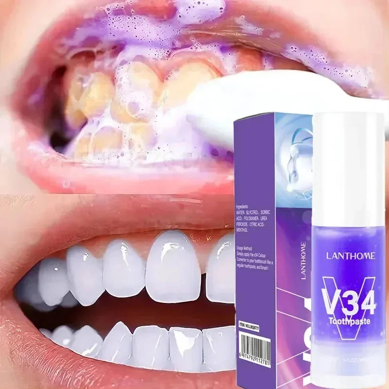 Clareador Dental Cream V34