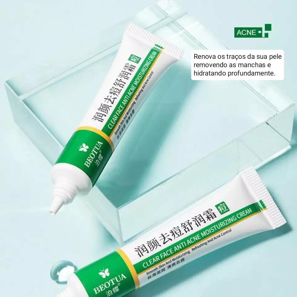 creme removedor de espinhas,antiacne,beotua,saude e beleza,pele limpa,pomada,cravos,pele oleosa