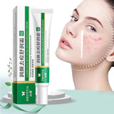 Creme Removedor de Espinhas™ - Limpeza Profunda Perfect Face