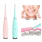 Removedor De Tártaro E Placas Bacterianas Tooth Cleaner - Limpador Dental - Loja Zenas