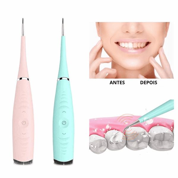 Removedor De Tártaro E Placas Bacterianas Tooth Cleaner - Limpador Dental - Loja Zenas